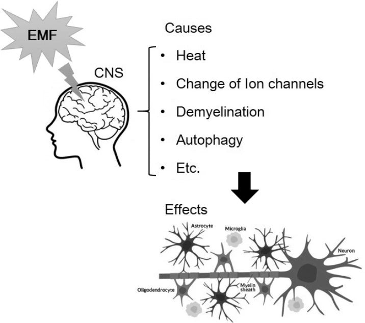 Brain effect illustration